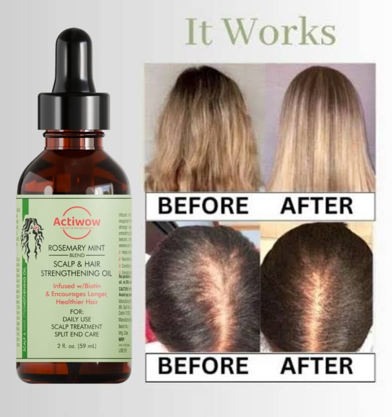 Actiwow Rosemary Mint Scalp & Hair Strengthning Oil (60ml) Actiwow